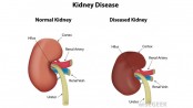 Lab-grown kidneys work in animals