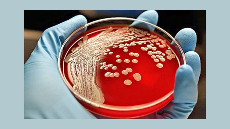 Antibiotic resistance requires global response similar to AIDS, climate change