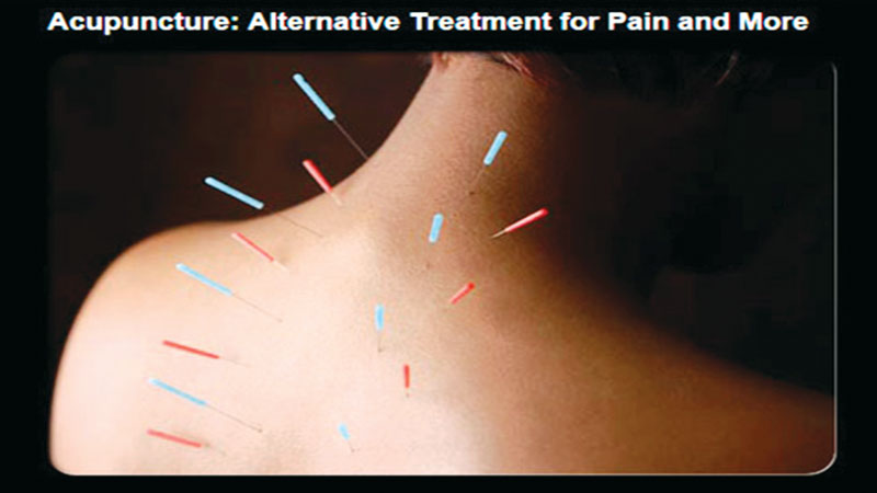 Acupuncture facts