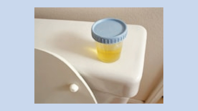 Alarming rise in antibiotic-resistant UTIs in U.S.