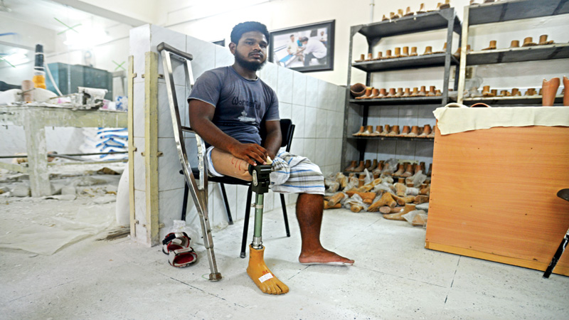 Artificial limbs 