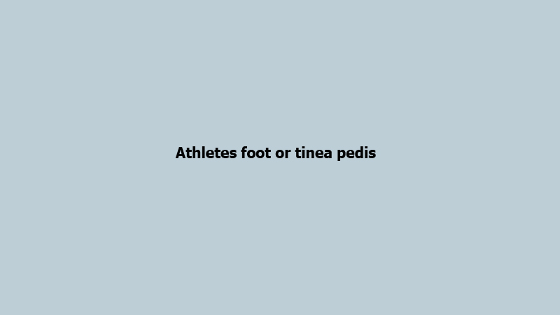 Athletes foot or tinea pedis