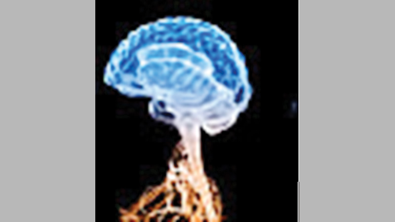 Understanding Autism 