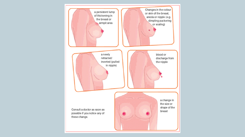 Breast cancer does have an answer!