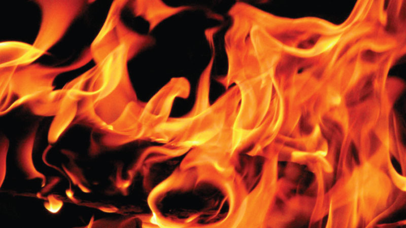Burn injuries: A guide for patients 