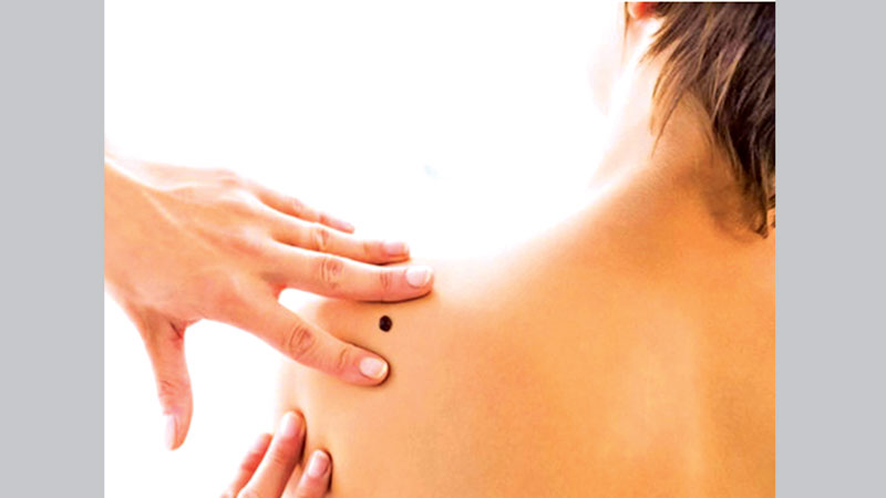 Check for signs of skin cancer