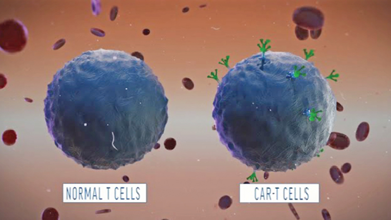 Chinese doctors are using modified T-Cells to treat advanced forms of cancer
