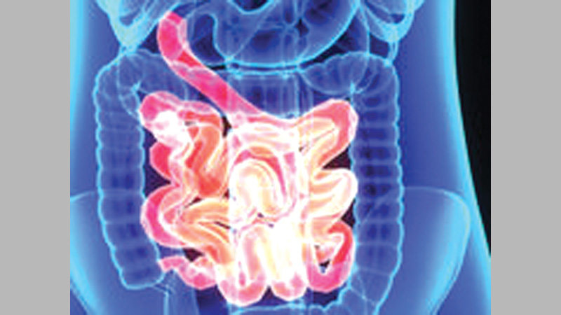Six ways to reduce your 
risk of colon cancer
