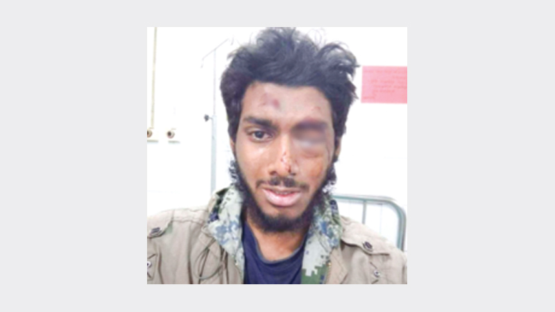 DU student Ehsan Rafiq will receive prolonged treatment