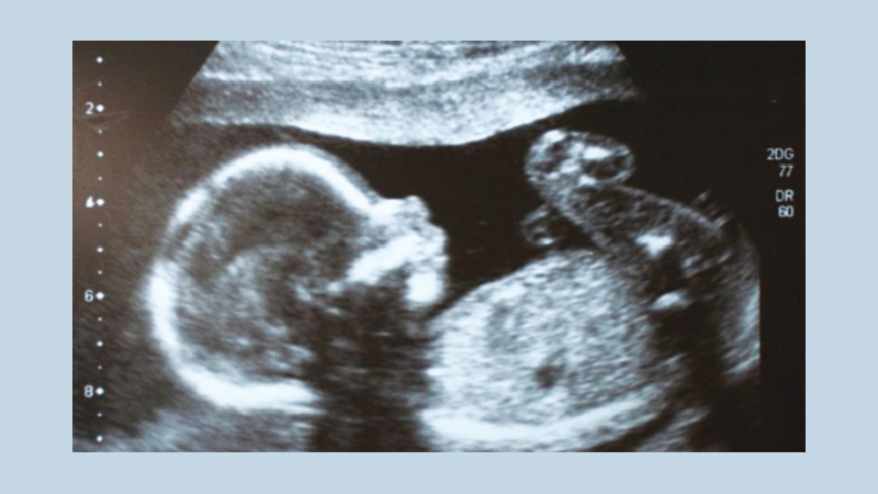 Editing human embryos 'morally permissible'