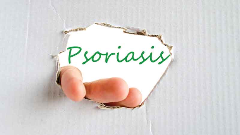 Enstilar (betamethasone and calcipotriene)