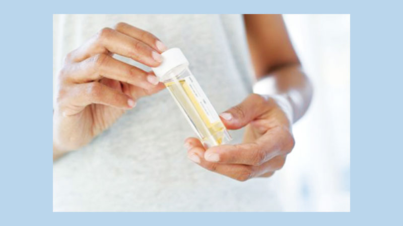 Everything you should know about urinary tract infections (UTIs) in men