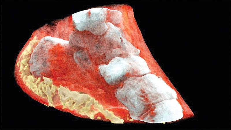First-ever colour X-ray on a human