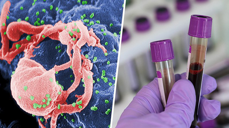 Studies show success in HIV  prevention drugs: Scientists