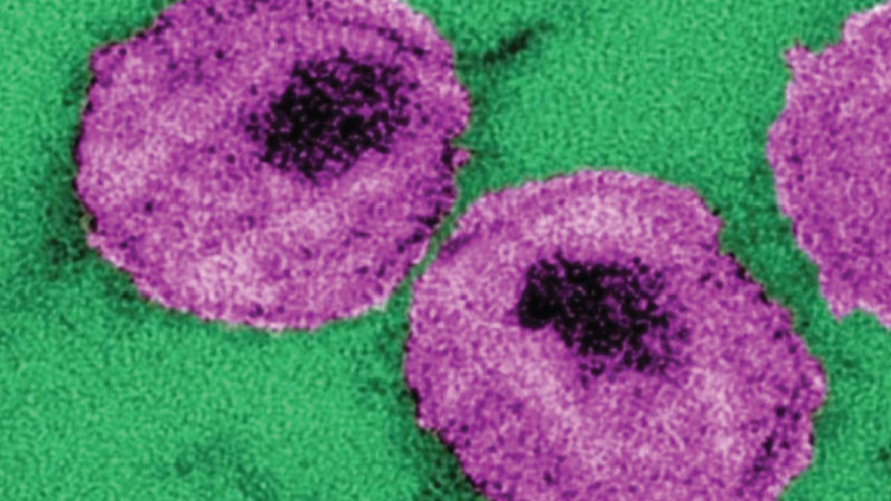 Cure for HIV reportedly 3 years away