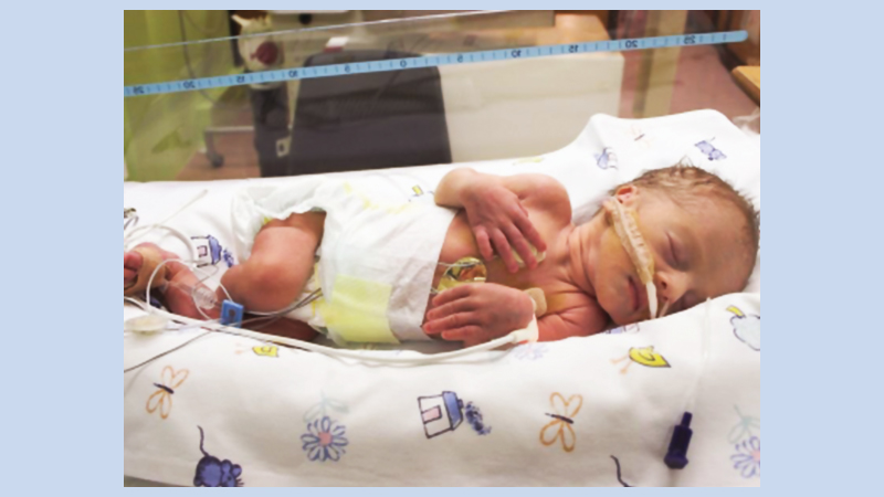 Inflammation in the womb may explain why some babies are more prone to sepsis after birth