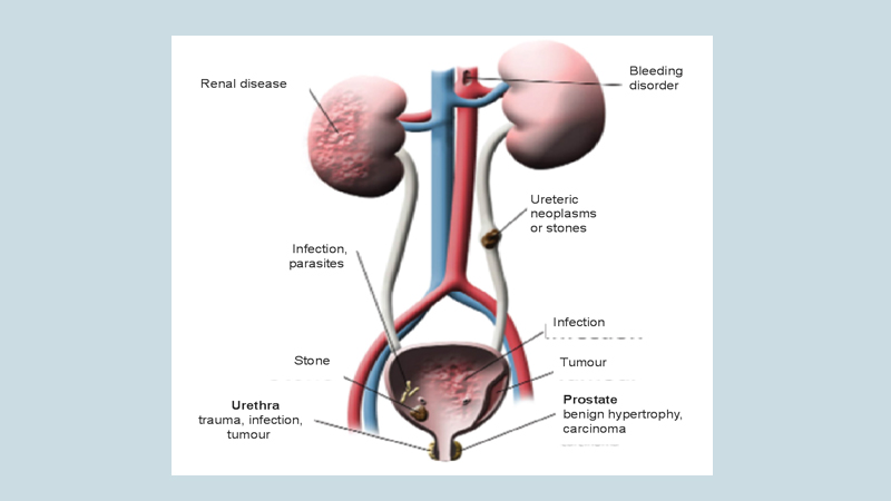 Kidney and urinary tract function, disorders and diseases