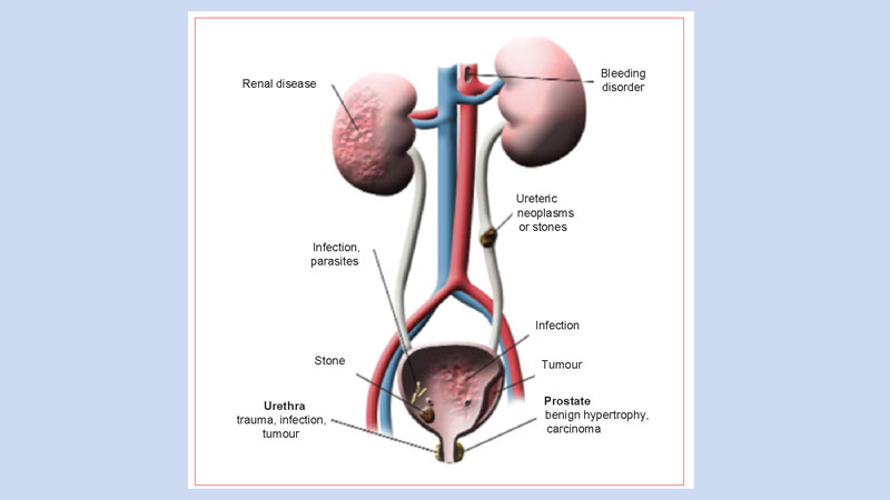Kidney and urinary tract  
function, disorders and diseases