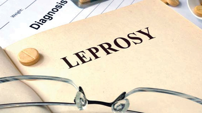 In quest of a country free from leprosy   