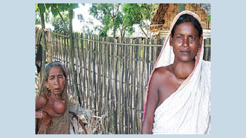 Maternal Iodine deﬁciency in rural Bangladesh 