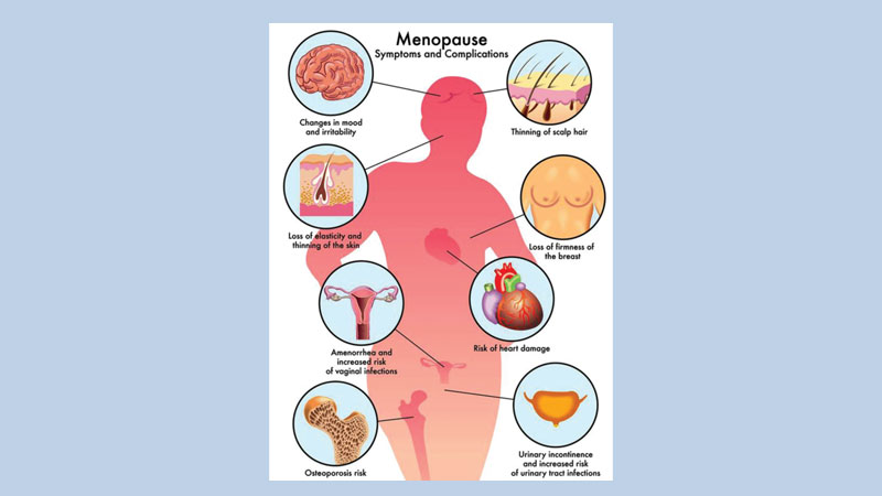 Menopause