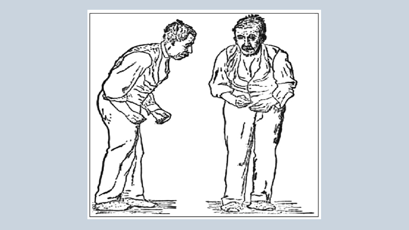 Occupational therapy for parkinson’s disease