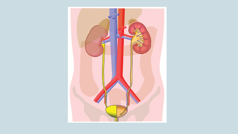 Paediatric kidney and 
urology disorders