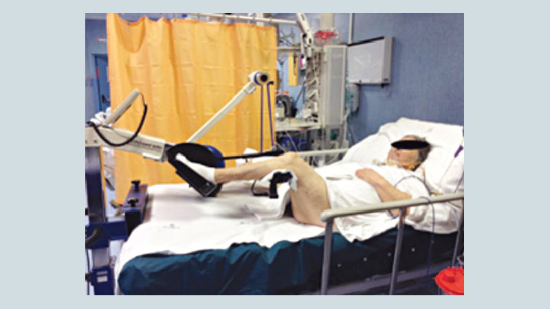 Physiotherapy is one of the vital treatment options of patient in ICU