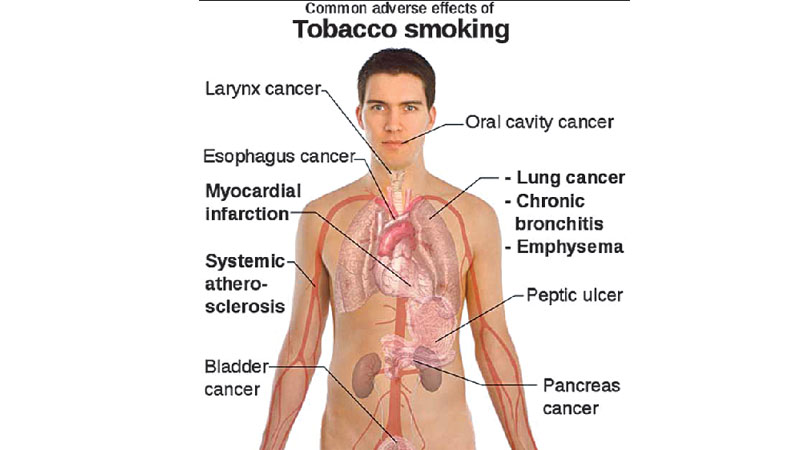 We must stop the consumption of tobacco
