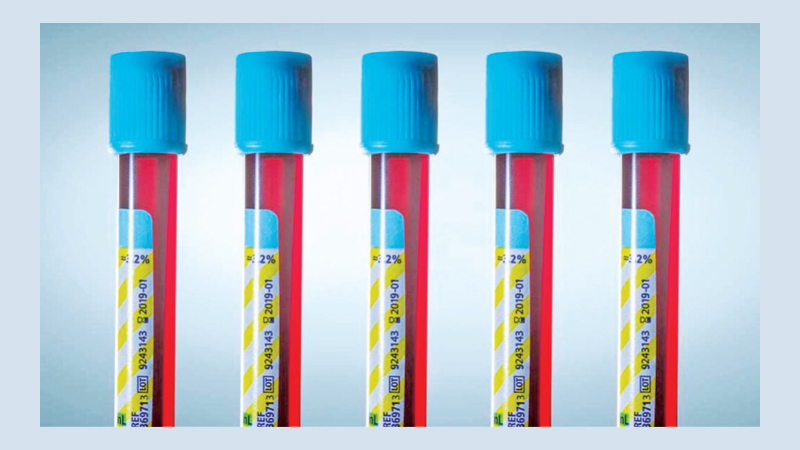 Pros and cons of 18 medical tests