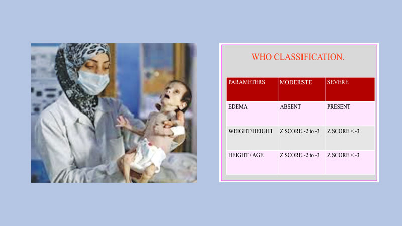 Severe Acute Malnutrition [SAM] among children from mothers’ perspective