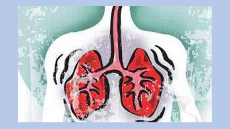 Detecting TB patients to ensure treatment stressed
