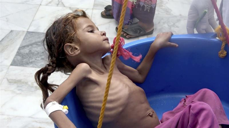 Yemen at risk of ‘big famine’: UN 