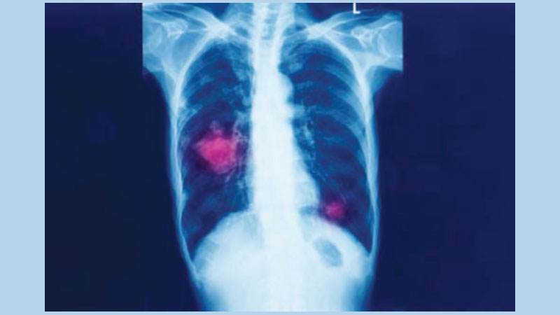 What exactly is a disease?