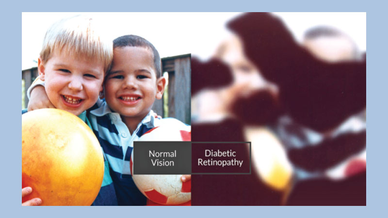WHO priority eye diseases