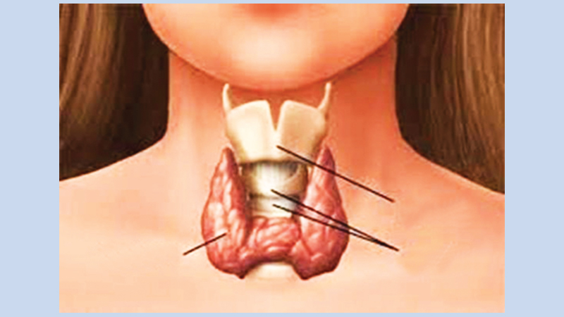 Diverse presentations of hypothyroidism