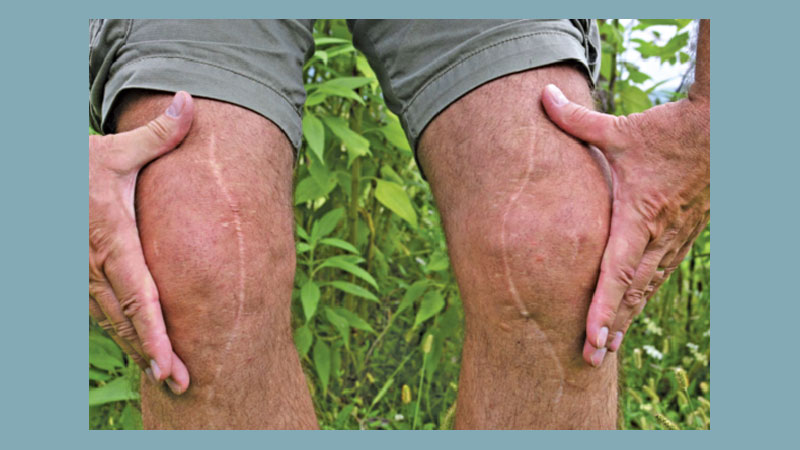 Surgery-free pain relief for hips and knees