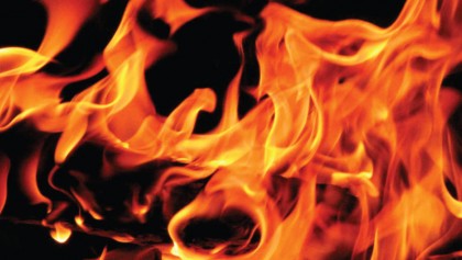 Burn injuries: A guide for patients 
