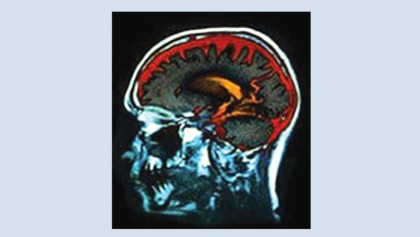 Cognitive health 
information