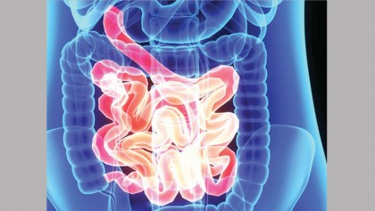 Colonoscopy after 75 may not be 
worth it : Study 
