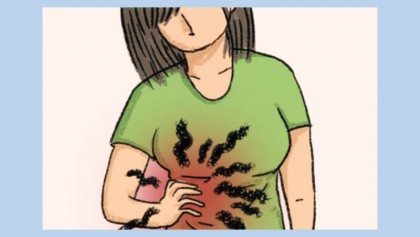 Everything there is to know about Crohn's disease, the digestive 
disorder on the rise