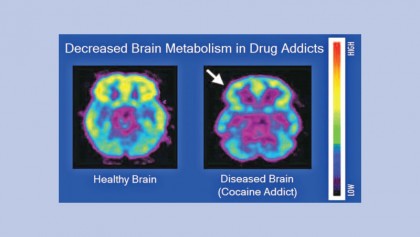 Drug abuse and addiction