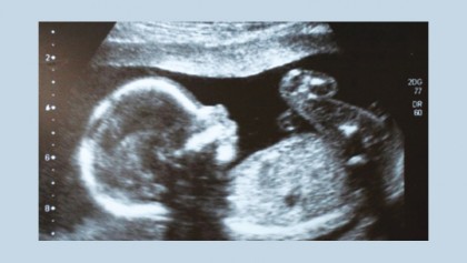 Editing human embryos 'morally permissible'
