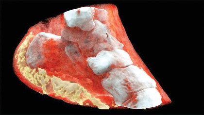 First-ever colour X-ray on a human