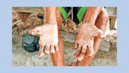 Global Leprosy Strategy 2016-2020