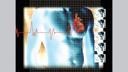 Good BP, blood sugar 
levels can prevent 
heart block
