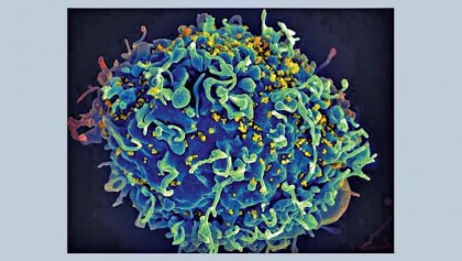 HIV is still growing, even when undetectable in the blood