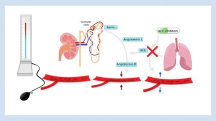 Hypertension: Preventive approaches