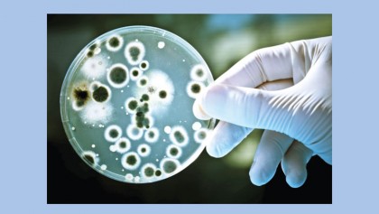 Infectious diseases