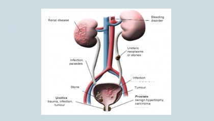 Kidney and urinary tract function, disorders and diseases